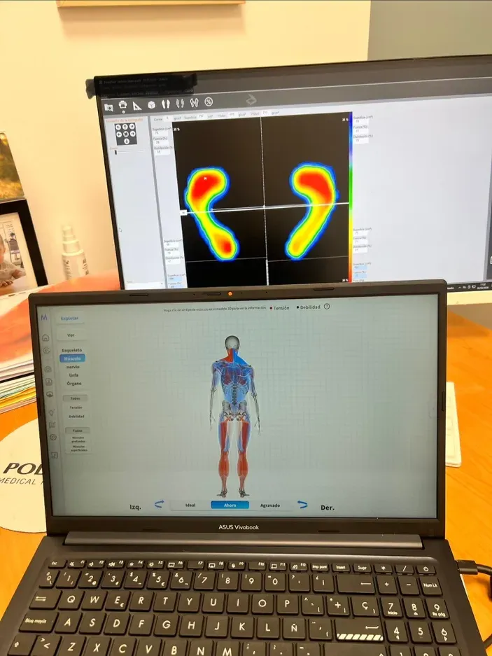 Análisis dinámico de la marcha con sensores mostrando carga adelantada durante todo el ciclo de pisada