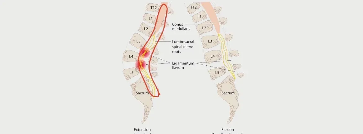 Esquema visual de la cadena cinética entre pie, miembro inferior y columna lumbar; ilustra cómo un problema proximal puede manifestarse en los dedos del pie