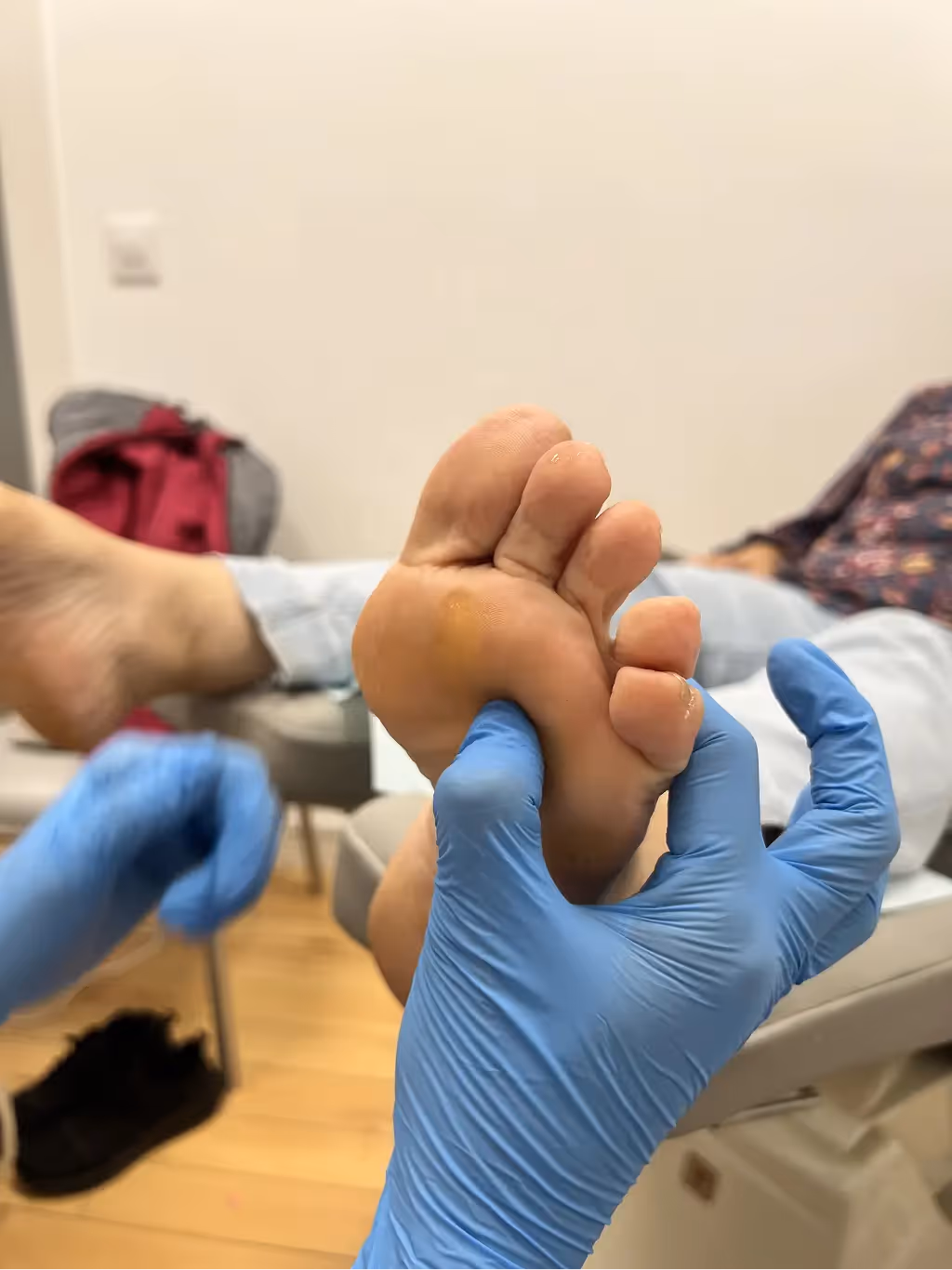 Corredora con dolor en el antepié por neuroma de Morton durante entrenamiento