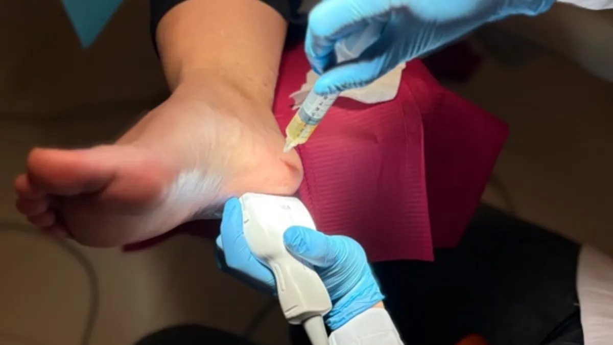Infiltración ecoguiada de plasma rico en plaquetas (PRP) en el talón de una paciente con fasciopatía plantar crónica en Centro Podológico Henao Bilbao
