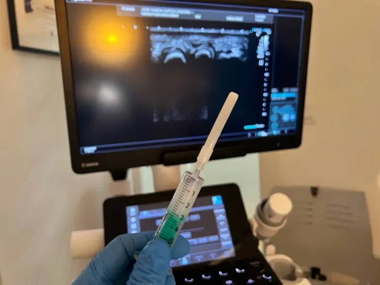 Control ecográfico en tiempo real: visualización de estructuras y guía de aguja durante infiltración ecoguiada