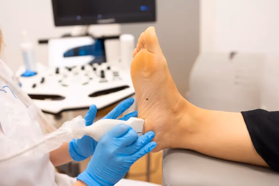 Electrólisis percutánea ecoguiada aplicada en tendón de Aquiles