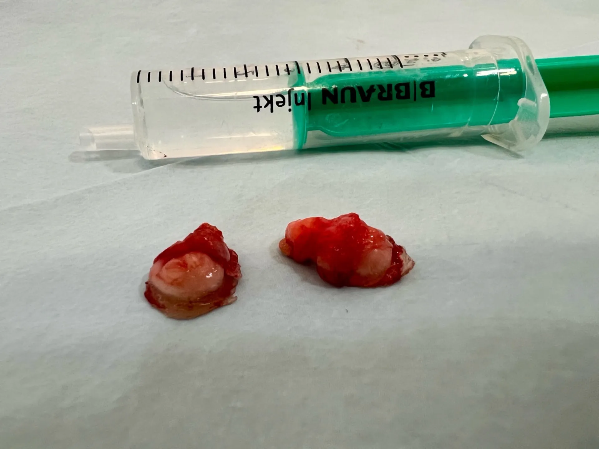 Estado a las 48 horas