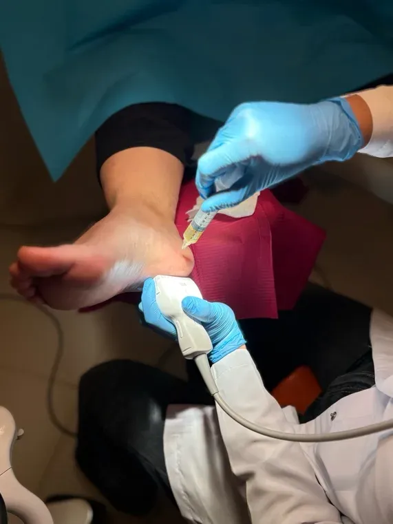Infiltración ecoguiada de plasma rico en plaquetas (PRP) en el talón de una paciente con fasciopatía plantar crónica, realizada por la Dra. Gisela en Centro Podológico Henao Bilbao