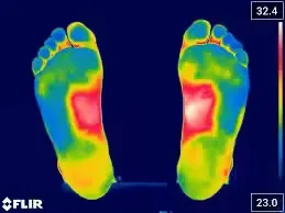 Imagen termográfica de un pie mostrando variaciones de temperatura en colores para diagnóstico podológico