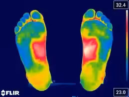 Imagen termográfica de un pie mostrando variaciones de temperatura en colores para diagnóstico podológico