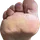 Diabetes y Dolor de Pies