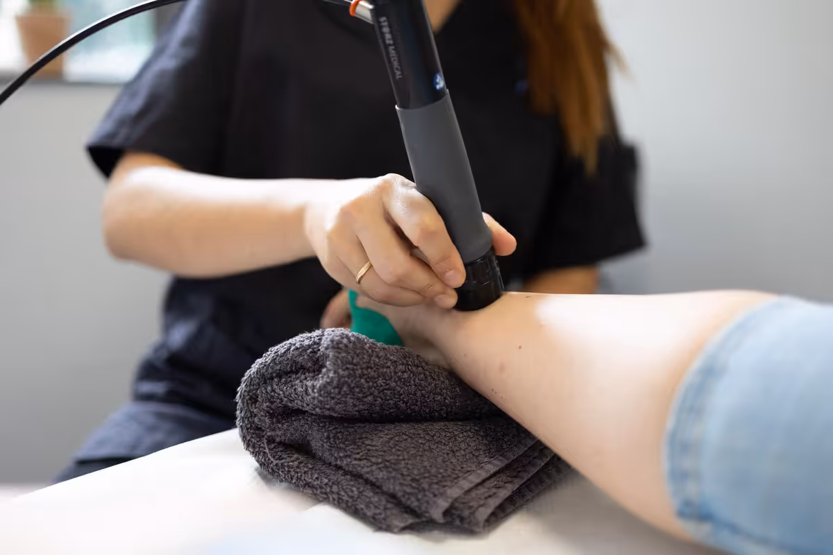 Aplicación de ondas de choque focales en fascia plantar para tratamiento de fascitis