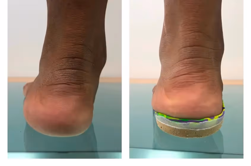 Exploración podológica infantil especializada en Bilbao