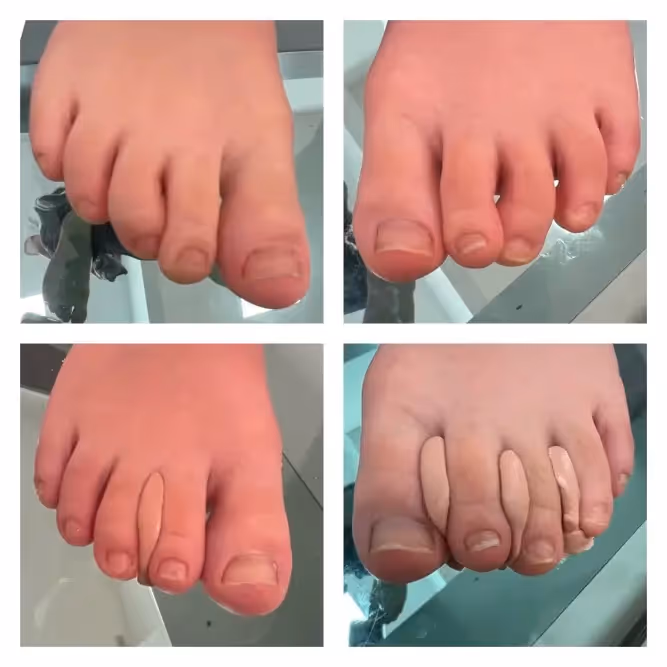 Diagnóstico podológico para el desarrollo saludable de los pies de los niños