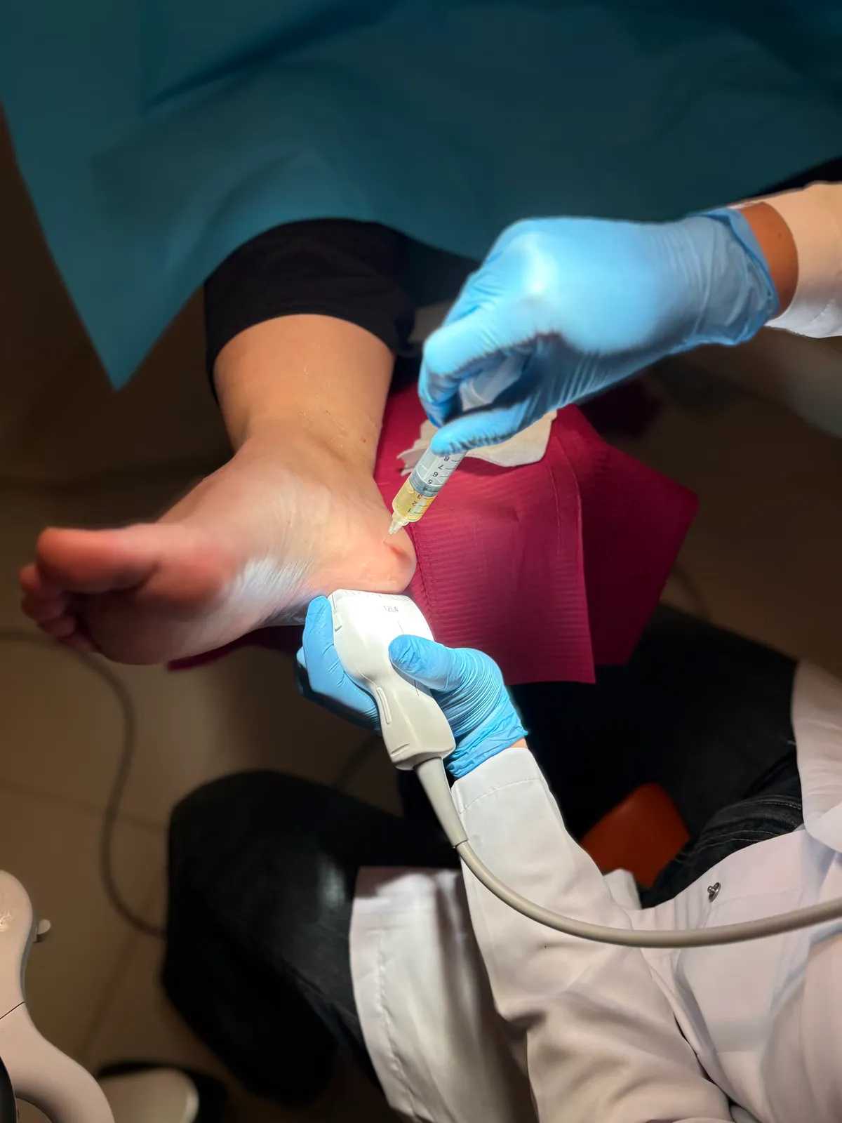 Plasma Rico en Plaquetas (PRP)