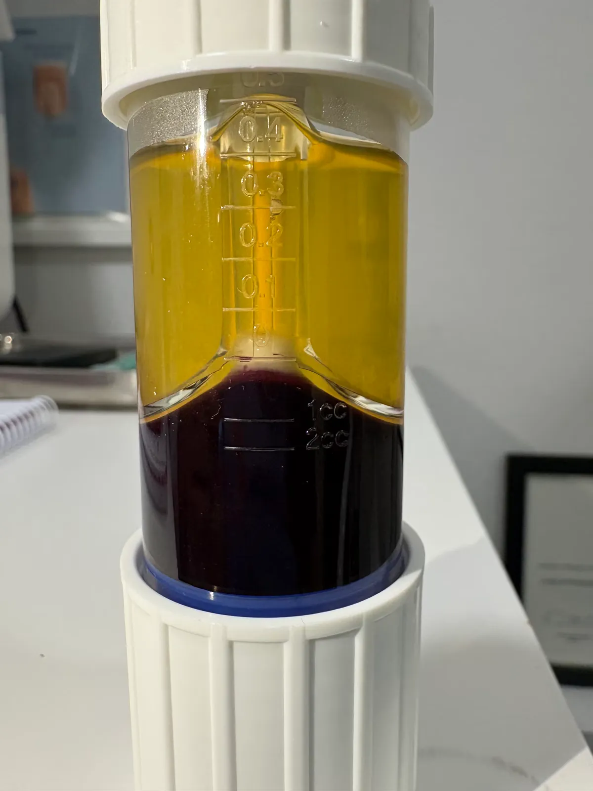 Tubo separador con plasma rico en plaquetas tras centrifugación, preparado para infiltración intraarticular en Centro Podológico Henao Bilbao