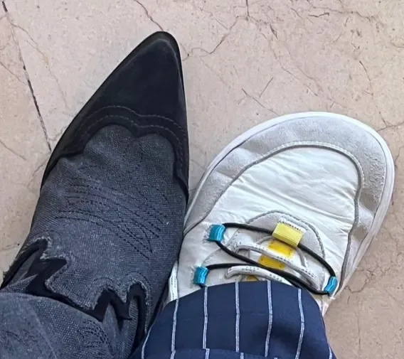 Juanete con desviación del dedo gordo del pie