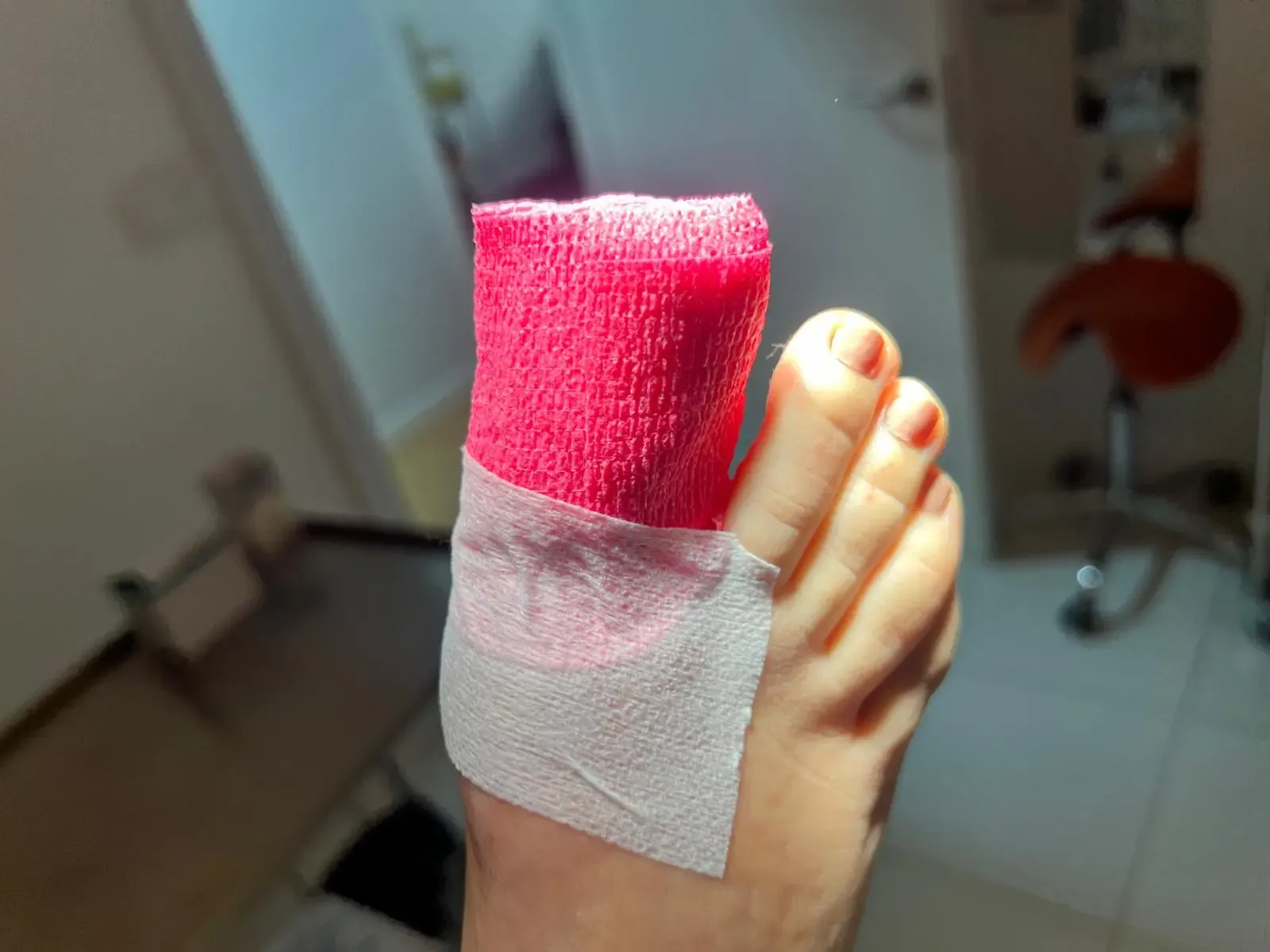 Vendaje compresivo aplicado tras el tratamiento de multipunción Falknor en Centro Podológico Henao